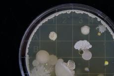 Schimmelpilz mit Sporen (unter dem Mikroskop)  